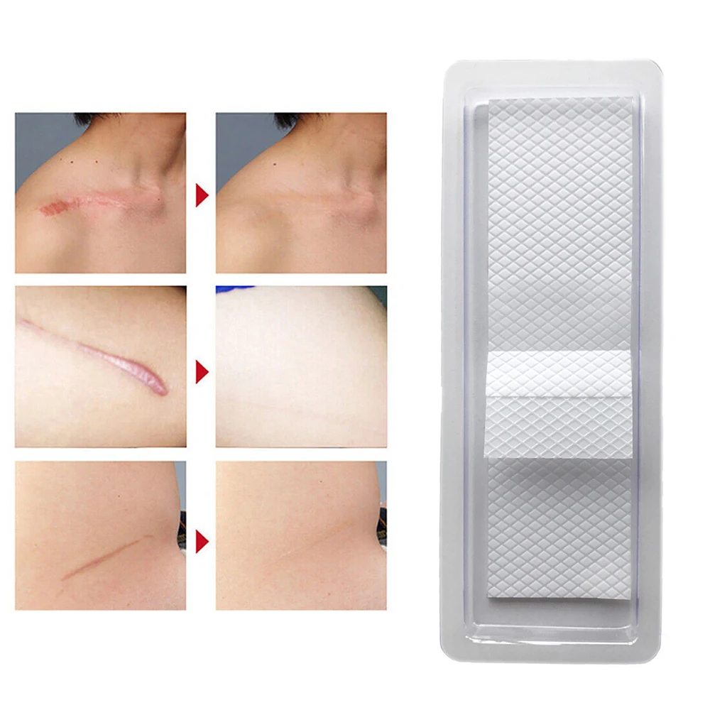 1pc Silicone Gel Scar Sheet Removal Patch Reusable Acne Gel Scar Therapy Silicon Patch Scar Trauma Burn Sheet Skin Repair
1pc Silicone Gel Scar Sheet Removal Patch Reusable Acne Gel Scar Therapy Silicon Patch Scar Trauma Burn Sheet Skin Repair