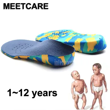 1-12 Years Kids Orthotics Insole X O Type Legs Arch Support Shoes Cushion Children Feet Valgus Correction Flat Foot Feet Care
1-12 Years Kids Orthotics Insole X O Type Legs Arch Support Shoes Cushion Children Feet Valgus Correction Flat Foot Feet Care