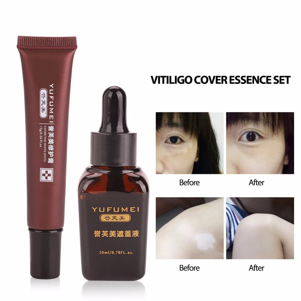 Professional Tattoo Concealer Vitiligo Scars Birthmarks Cover Plant Essence Set Tattoo Skin Repair Cream + Cover Liquid + Brush
Professional Tattoo Concealer Vitiligo Scars Birthmarks Cover Plant Essence Set Tattoo Skin Repair Cream + Cover Liquid + Brush