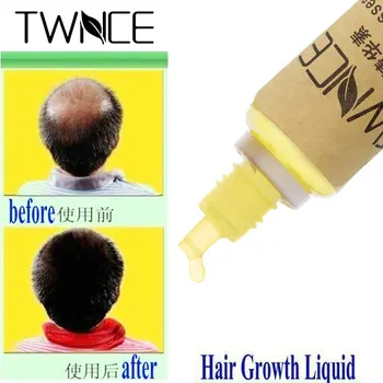 TWNCE Hair Growth Essence Hair Loss Liquid 20ml dense fast sunburst grow Restoration