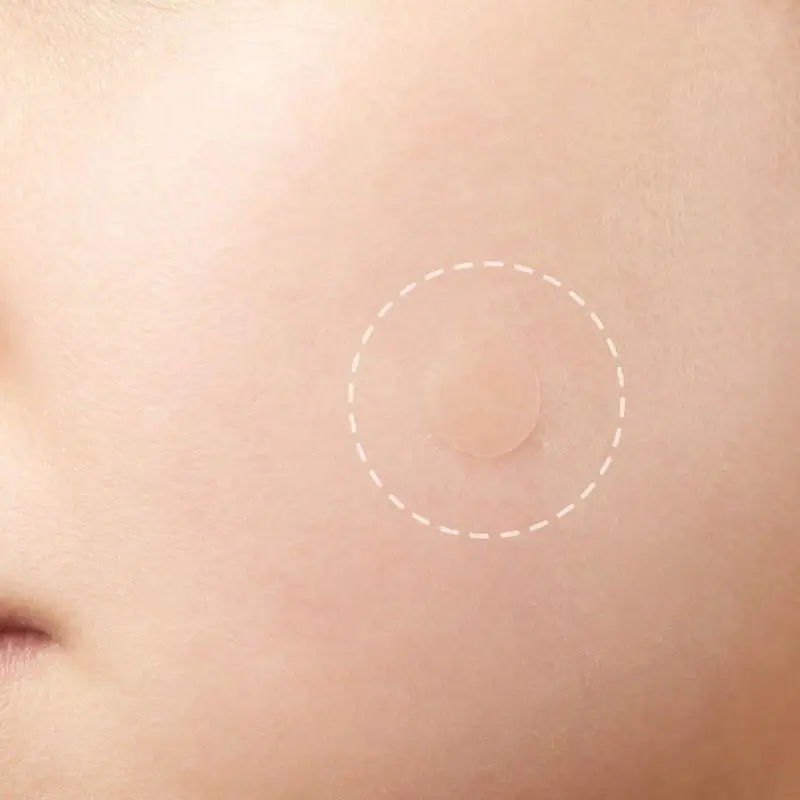 24 Patches/Sheet/Bag Hydrocolloid Invisible Acne Pimple Patches Face Spot Scar Care Treatment Stickers 2018 new face care
24 Patches/Sheet/Bag Hydrocolloid Invisible Acne Pimple Patches Face Spot Scar Care Treatment Stickers 2018 new face care