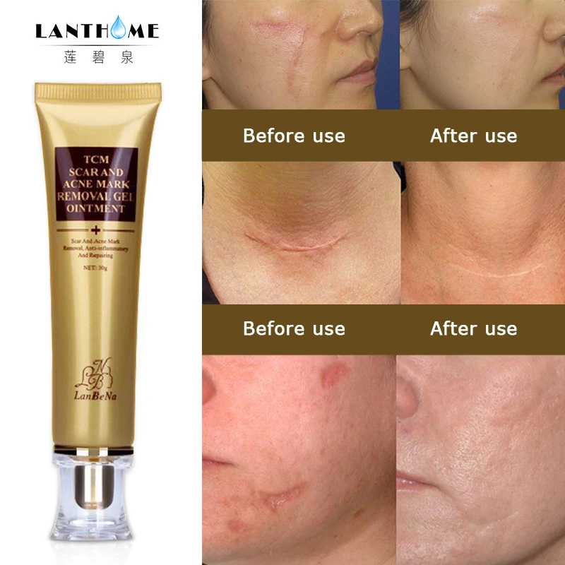 LANBENA Acne Scar Stretch Marks Remover Cream Skin Repair Face Cream Acne Spots Acne Treatment Blackhead Whitening Cream 30ml
LANBENA Acne Scar Stretch Marks Remover Cream Skin Repair Face Cream Acne Spots Acne Treatment Blackhead Whitening Cream 30ml