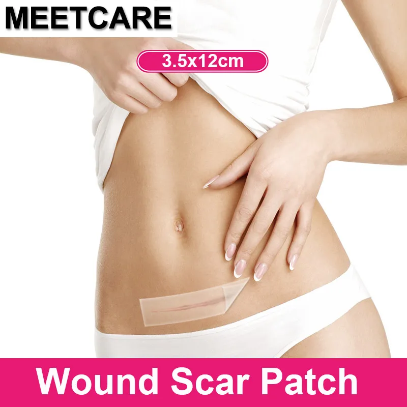 Medical Scar Away Silicone Gel Patch Wound Marks Removal Cesarean Section Hypertrophic Keloid Skin Scars Therapy For Care Beauty
Medical Scar Away Silicone Gel Patch Wound Marks Removal Cesarean Section Hypertrophic Keloid Skin Scars Therapy For Care Beauty