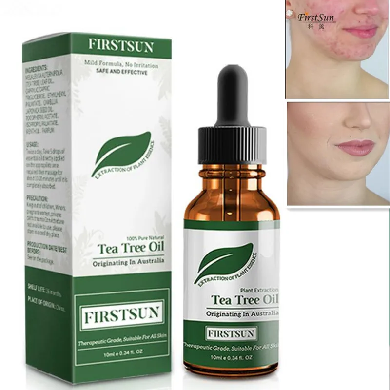 10MLPure Organic Tree Tea Essential Oils Moisturizing Massage Oil Control Fade Acne Scar Removal Cystic Treatment Blackhead Pore
10MLPure Organic Tree Tea Essential Oils Moisturizing Massage Oil Control Fade Acne Scar Removal Cystic Treatment Blackhead Pore