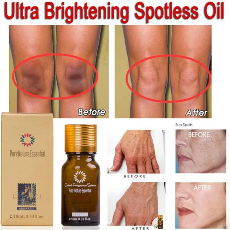 Ultra Brightening Spotless Oil Pure Remove Ance Burn Strentch Marks Scar Removal Lavender Natural Essence Skin Care
Ultra Brightening Spotless Oil Pure Remove Ance Burn Strentch Marks Scar Removal Lavender Natural Essence Skin Care