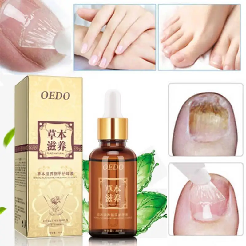 Fungal Nail Treatment Essence Nail and Foot Whitening Toe Nail Fungus Removal Feet Care Nail Gel Makeup Set Tool #508
Fungal Nail Treatment Essence Nail and Foot Whitening Toe Nail Fungus Removal Feet Care Nail Gel Makeup Set Tool #508