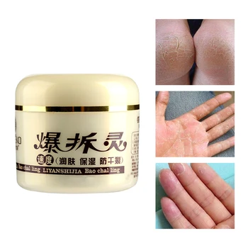 Effective Hand Foot Heel Anti-Dry Crack Repair Massage Cream Moisturizing Nourish Gentle Skin Care Anti-Drying Chapping Peeling
Effective Hand Foot Heel Anti-Dry Crack Repair Massage Cream Moisturizing Nourish Gentle Skin Care Anti-Drying Chapping Peeling