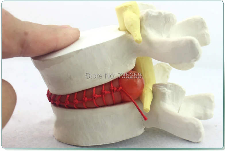 Human Lumbar Disc Demonstration Model,Lumbar Disk Disease Model,Lumbar Spine Model
Human Lumbar Disc Demonstration Model,Lumbar Disk Disease Model,Lumbar Spine Model