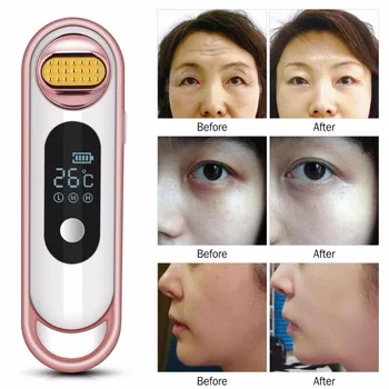 Face Skin Lifting V Face RF Facial Thermage Radio Frequency Machine Pore Cleaner Wrinkle Remover Anti-Aging Skin Device Home Use 
Face Skin Lifting V Face RF Facial Thermage Radio Frequency Machine Pore Cleaner Wrinkle Remover Anti-Aging Skin Device Home Use