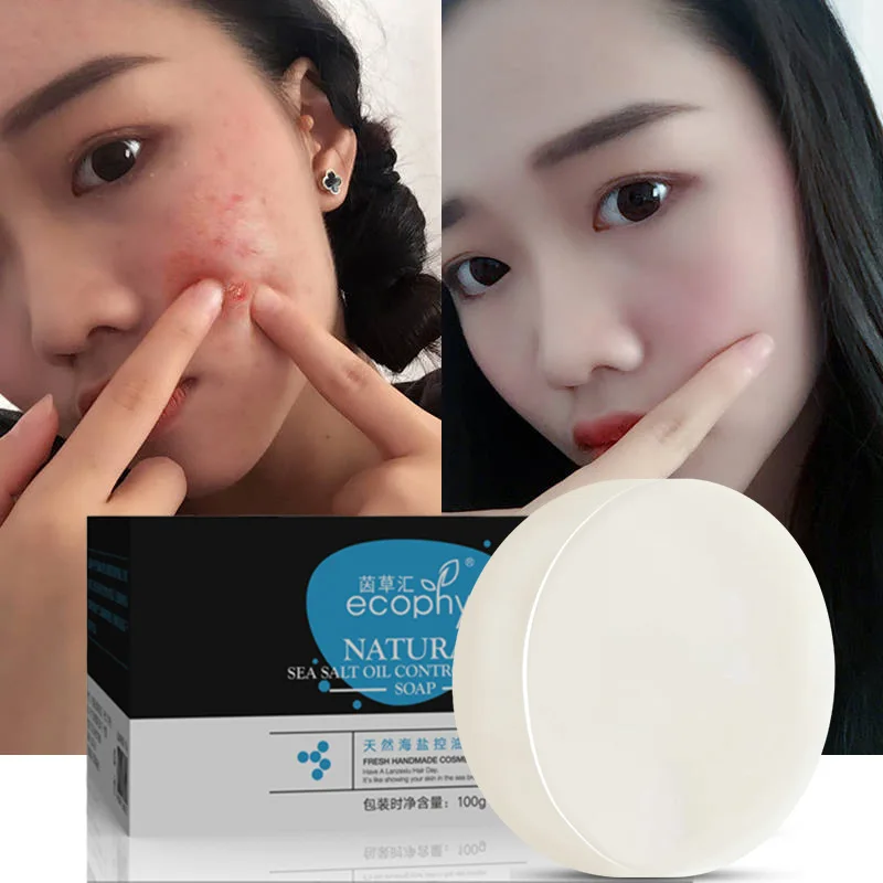 Ecophy 100g Sea Salt Soap Cleaner Removal Pimple Pores Acne Treatment Goat Milk Moisturizing Face Wash Soap Skin Care
Ecophy 100g Sea Salt Soap Cleaner Removal Pimple Pores Acne Treatment Goat Milk Moisturizing Face Wash Soap Skin Care