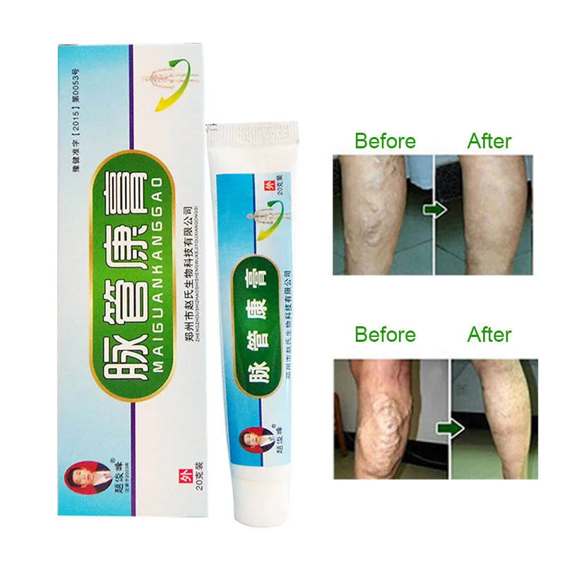20 g/box Chinese Natural Herbal Medicine Sophora Varicose Vein Ointment Massage for Treating Varicose Vascular
20 g/box Chinese Natural Herbal Medicine Sophora Varicose Vein Ointment Massage for Treating Varicose Vascular