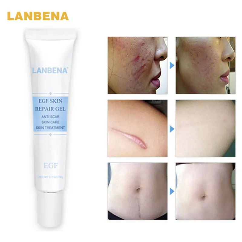 Natural Messager LANBENA EGF SKIN REPAIR GEL Pigmentation Corrector Skin Care Acne Treatment Blackhead Whitening Cream DC88
Natural Messager LANBENA EGF SKIN REPAIR GEL Pigmentation Corrector Skin Care Acne Treatment Blackhead Whitening Cream DC88