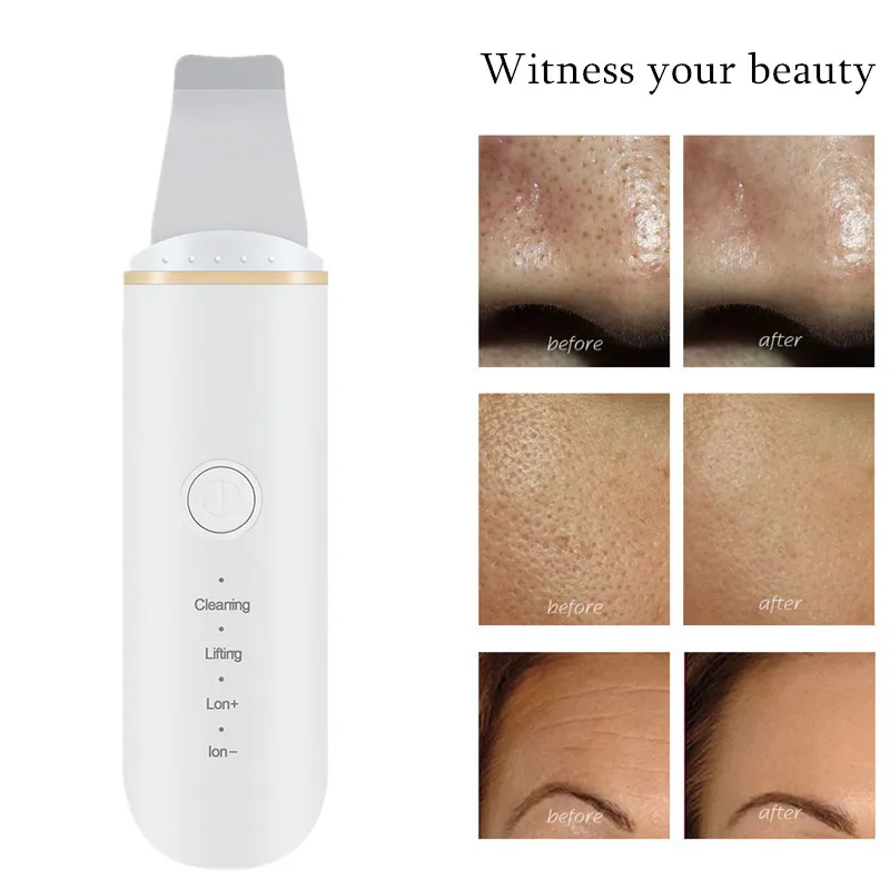 Facial Skin Scrubber Blackhead Remover Pore Cleaner USB Rechargeable Skin Massage Scrubber for Deep Clean Facial Lifting Tool
Facial Skin Scrubber Blackhead Remover Pore Cleaner USB Rechargeable Skin Massage Scrubber for Deep Clean Facial Lifting Tool