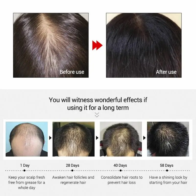Andrea Fast Hair Growth Alopecia Loss Liquid Ginger Sunburst Yuda