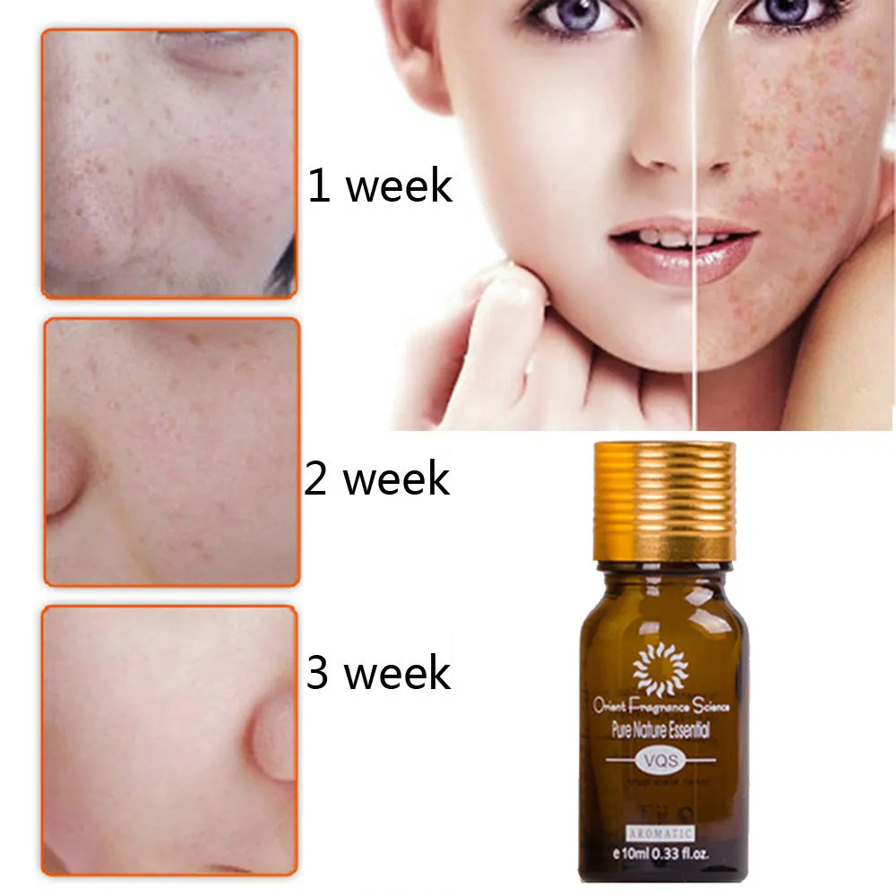 Essential Oil Remove Scar Freckle Blemish Essential Oil Decomposition Pigment Whiten Moisturizing Anti Wrinkle #40
Essential Oil Remove Scar Freckle Blemish Essential Oil Decomposition Pigment Whiten Moisturizing Anti Wrinkle #40