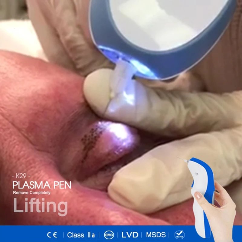 4th generation skin plasma lifting spot mole machine tattoo beauty laser lift pen Freckle Removal Machine 10pcs needles
4th generation skin plasma lifting spot mole machine tattoo beauty laser lift pen Freckle Removal Machine 10pcs needles