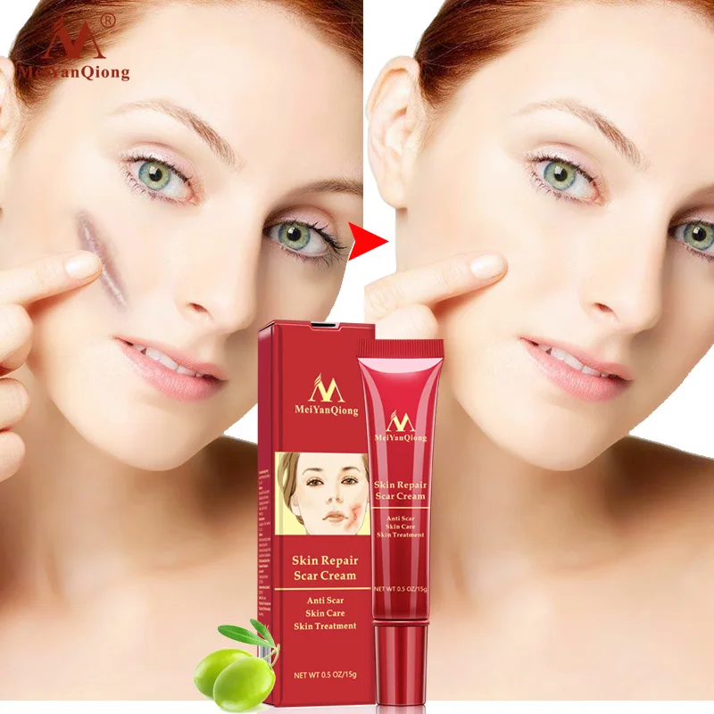 Scar Repair Cream Skin Care Natural Acne Remove Burn Stretch Marks Scar Removal SSwell
Scar Repair Cream Skin Care Natural Acne Remove Burn Stretch Marks Scar Removal SSwell