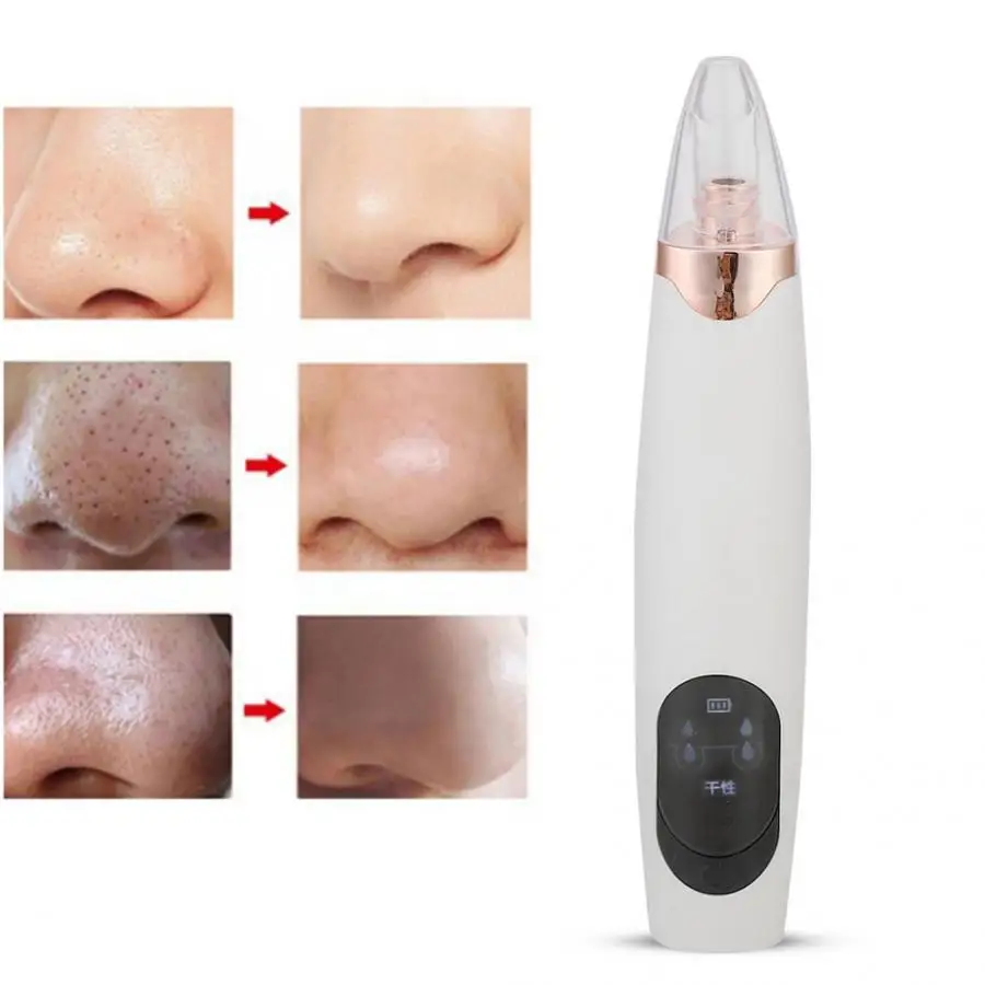 Professional Electronic Face Pore Cleaner Blackhead Removal Suction Machine Reduce Grease Beauty Device Face Skin Care Tools
Professional Electronic Face Pore Cleaner Blackhead Removal Suction Machine Reduce Grease Beauty Device Face Skin Care Tools
