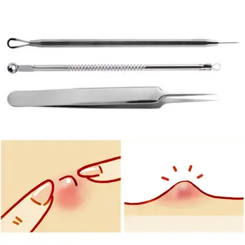 3Pcs/Set Blackhead Remover Comedones Pimple Extractor Acne Blemish Removal Kit Stainless Steel Needle Tweezer Clean Tool
3Pcs/Set Blackhead Remover Comedones Pimple Extractor Acne Blemish Removal Kit Stainless Steel Needle Tweezer Clean Tool