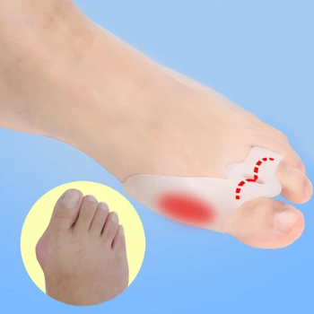 New 1Pair Daily Thumb Valgus Correction Device Toe Separator Toe Overlap Orthopedic Bone Thumb Orthotics Braces Feet Care
New 1Pair Daily Thumb Valgus Correction Device Toe Separator Toe Overlap Orthopedic Bone Thumb Orthotics Braces Feet Care