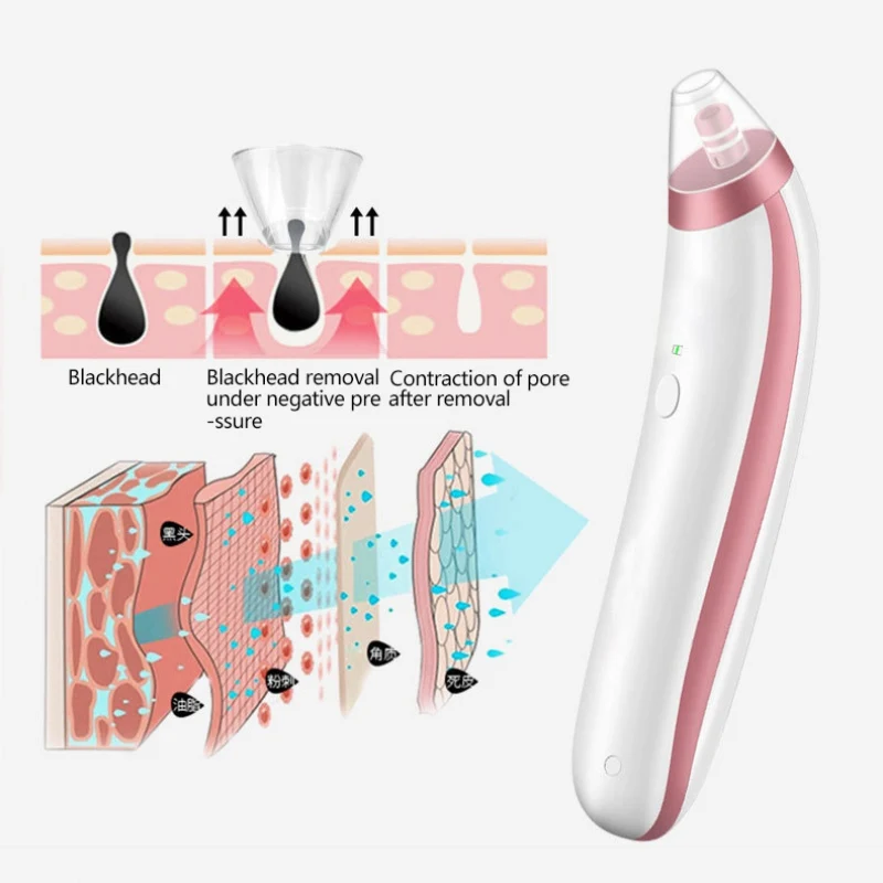 Electric Blackhead Vacuum Cleaner Pores Facial Nose Acne Blackhead Dissolved Skin Care Machine
Electric Blackhead Vacuum Cleaner Pores Facial Nose Acne Blackhead Dissolved Skin Care Machine