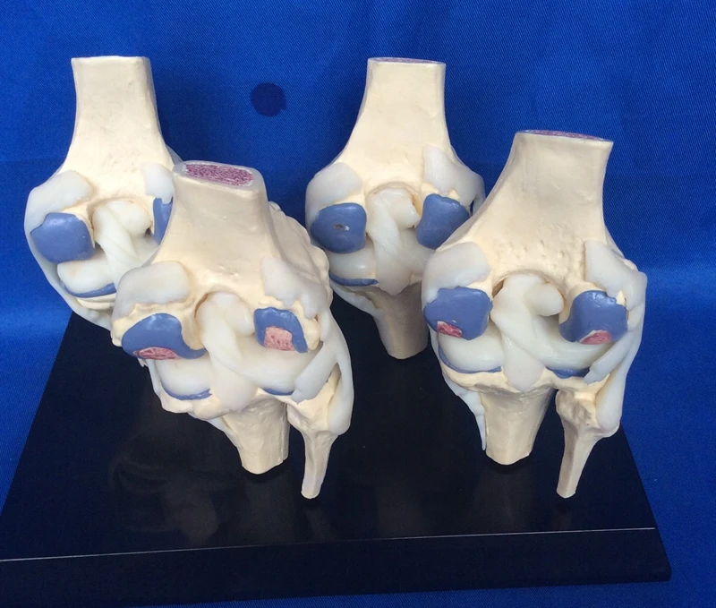 1:1 Life Size Human Knee Joint Model 4 Stage Knee Joint Disease Model Skeleton Model Anatomy Skull Medical Teaching Models
1:1 Life Size Human Knee Joint Model 4 Stage Knee Joint Disease Model Skeleton Model Anatomy Skull Medical Teaching Models