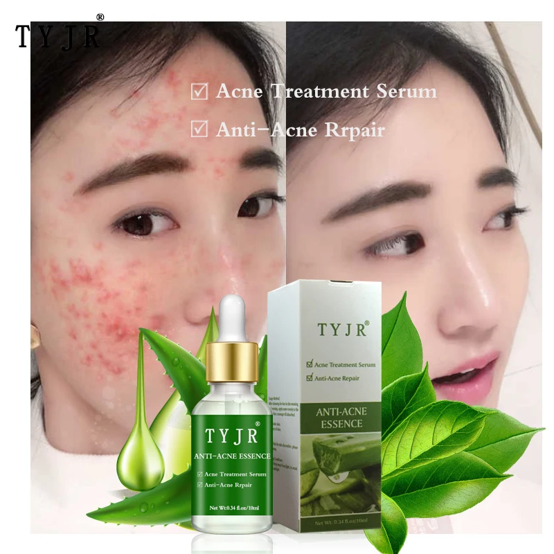 Aloe Vera&Snail&24KGold Foil Essence Acne Repair Skin Anti-Wrinkle Moisturizing Nourishing Whitening Facial Repair Care TSLM1
Aloe Vera&Snail&24KGold Foil Essence Acne Repair Skin Anti-Wrinkle Moisturizing Nourishing Whitening Facial Repair Care TSLM1