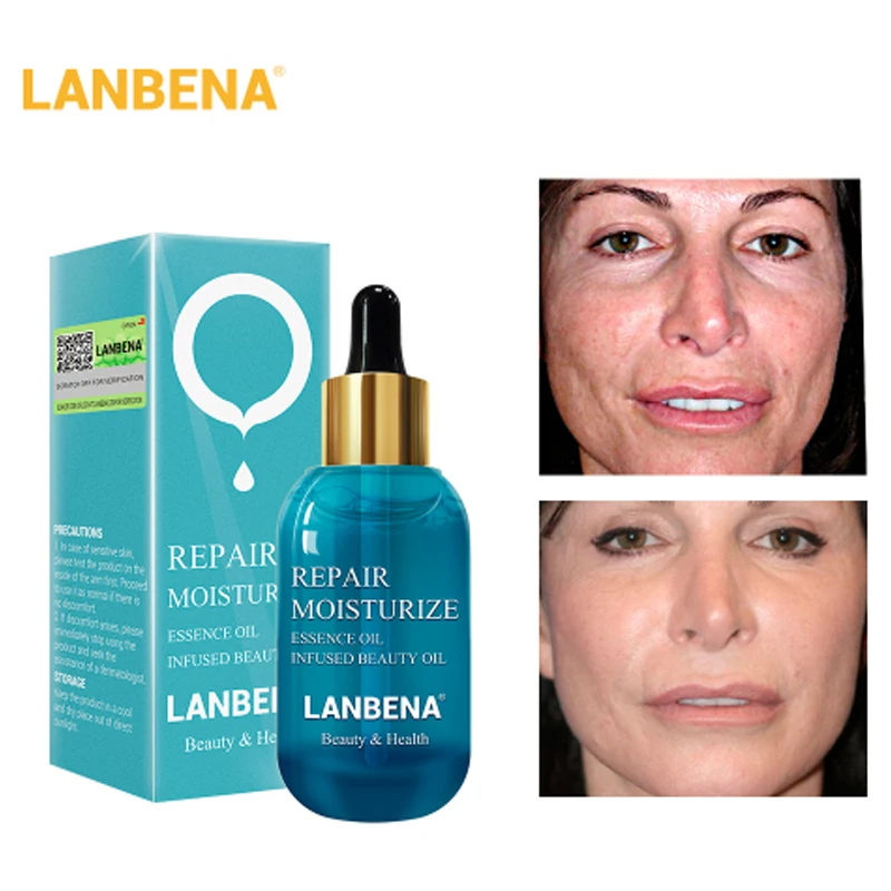 LANBENA Hyaluronic Acid Repair Essential Oil Skin Serum Face Cream Moisturizing Nourishing Acne Treatment Oil Control Whitening
LANBENA Hyaluronic Acid Repair Essential Oil Skin Serum Face Cream Moisturizing Nourishing Acne Treatment Oil Control Whitening