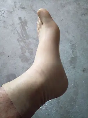 1(7)