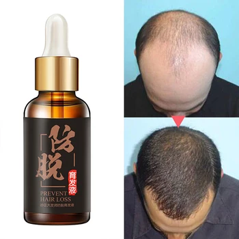 Hair Growth Essence Anti Hair Loss Liquid Dense Dropshipping Discounted Price Hair Hairstyle Keratin Hair Care Products 2019 HOT
Hair Growth Essence Anti Hair Loss Liquid Dense Dropshipping Discounted Price Hair Hairstyle Keratin Hair Care Products 2019 HOT