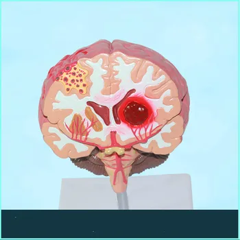 Life Size Humans Brain Stroke Anatomical Model Cerebral Palsy Brain Tumor Brain Disease Model Stroke Model Neurology Brain Model
Life Size Humans Brain Stroke Anatomical Model Cerebral Palsy Brain Tumor Brain Disease Model Stroke Model Neurology Brain Model