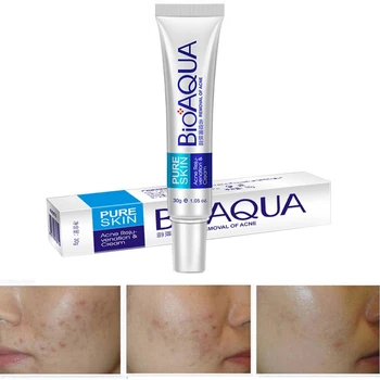 Bioaqua 30g Acne Treatment Blackhead Remova Anti Acne Cream Oil Control Shrink Pores Acne Scar Remove Face Care Whitening
Bioaqua 30g Acne Treatment Blackhead Remova Anti Acne Cream Oil Control Shrink Pores Acne Scar Remove Face Care Whitening