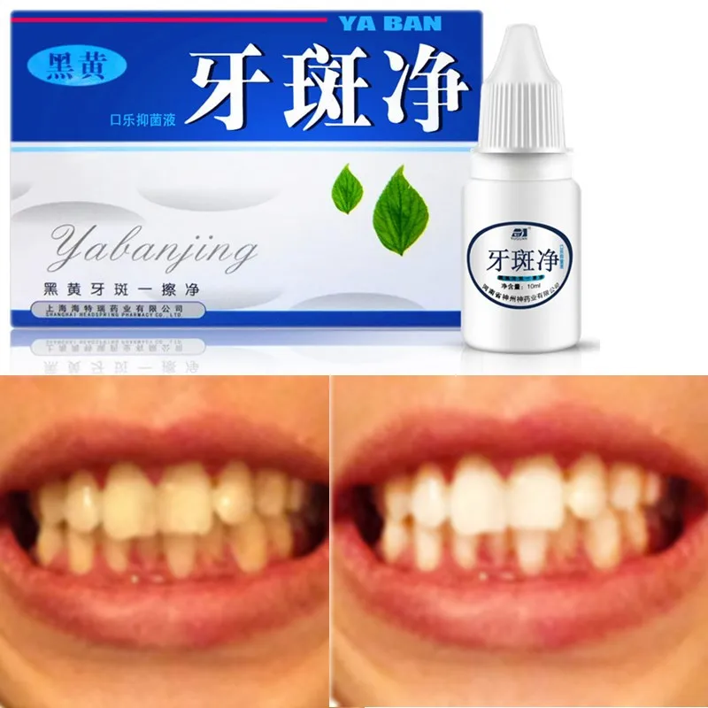 1 Bottle 10 Ml Teeth Whitening Tools Mouth Cleaning Liquid Whitening Dental Bleaching Dental Tooth Whitening Instrument
1 Bottle 10 Ml Teeth Whitening Tools Mouth Cleaning Liquid Whitening Dental Bleaching Dental Tooth Whitening Instrument