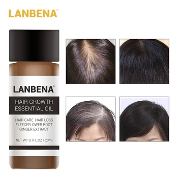 LANBENA Ginger Extract Treatment Fast Powerful Hair Growth Essence Products Essential Oil LiquidPrevent Hair Loss Andrea 20ml
LANBENA Ginger Extract Treatment Fast Powerful Hair Growth Essence Products Essential Oil LiquidPrevent Hair Loss Andrea 20ml