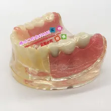 human model Dental model Comprehensive pathology detachable Implant repair crystal free shipping
human model Dental model Comprehensive pathology detachable Implant repair crystal free shipping