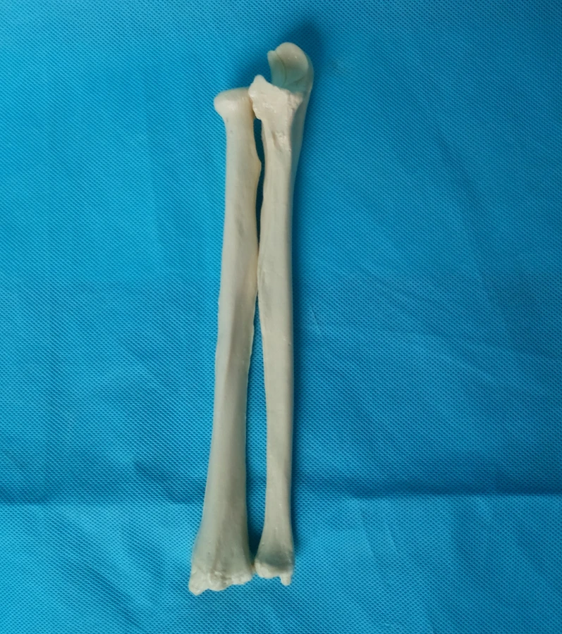 1 Pair Left and Right Human 1:1 Radius Model Medical Teaching Model Radius Cortical Bone Humans Skeleton Model Medical Specimen
1 Pair Left and Right Human 1:1 Radius Model Medical Teaching Model Radius Cortical Bone Humans Skeleton Model Medical Specimen