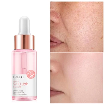 Face Serum Essence Moisturizing Sakura Serum Japan Extract Shrink Pores Remove Acne Hyaluronic Acid Vitamin C
Face Serum Essence Moisturizing Sakura Serum Japan Extract Shrink Pores Remove Acne Hyaluronic Acid Vitamin C