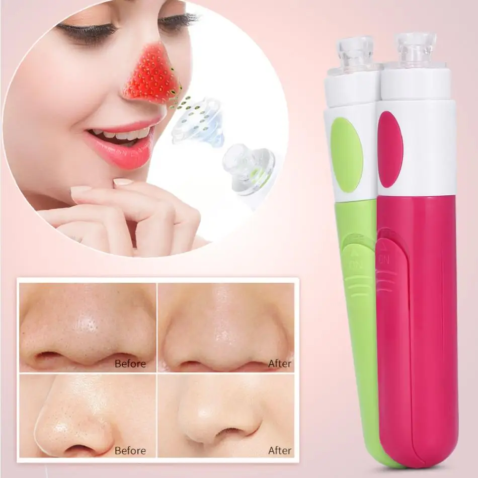 2 Colors mini Facial Pore Cleanser Blackhead Removal Vacuum Suction Acne Pimple Grease Cleaner Face Care Cleaner Machine
2 Colors mini Facial Pore Cleanser Blackhead Removal Vacuum Suction Acne Pimple Grease Cleaner Face Care Cleaner Machine
