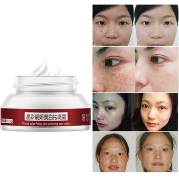 1pc Strong Effects Powerful Whitening Freckle Cream 15g Remove Melasma Acne Spots Pigment Melanin Dark Spots Face Care Cream
1pc Strong Effects Powerful Whitening Freckle Cream 15g Remove Melasma Acne Spots Pigment Melanin Dark Spots Face Care Cream