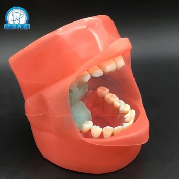 Dental Stomatology Teaching Model Extractable Teeth Demolition Teeth Simulation model
Dental Stomatology Teaching Model Extractable Teeth Demolition Teeth Simulation model