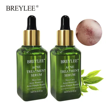 BREYLEE 2PCS Acne Treatment Serum Natural Facial Essence Acne Scar Removal Face Skin Care Whitening Repairing Pimples Remover
BREYLEE 2PCS Acne Treatment Serum Natural Facial Essence Acne Scar Removal Face Skin Care Whitening Repairing Pimples Remover