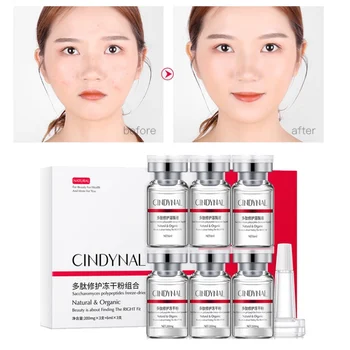 3 pairs Peptide Freeze-dried Powder Repairing Serum Epidermal Growth Factor Acne Removal Essence Freeze-dried Powder Skin Care 
3 pairs Peptide Freeze-dried Powder Repairing Serum Epidermal Growth Factor Acne Removal Essence Freeze-dried Powder Skin Care