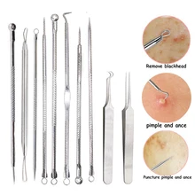 Preto dot espinha cravo removedor ferramenta agulhas para espremer acne ferramentas colher para rosto limpeza comedone extrator poros mais limpo(China)
