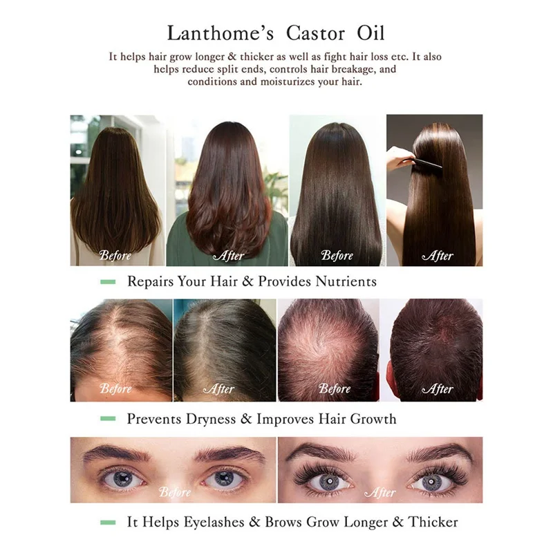 Black Castor Oil For Natural Hair Growth Essential Oil Castor