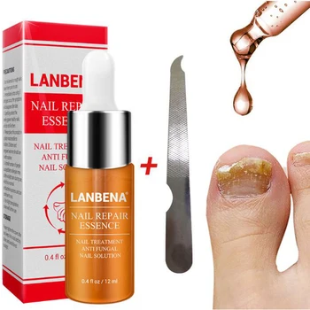 LANBENA From Nail Fungus Remedy of Foot Toe Nails Treatmemts Cure Means for Against Fungal Onychomycosis Repair Essence
LANBENA From Nail Fungus Remedy of Foot Toe Nails Treatmemts Cure Means for Against Fungal Onychomycosis Repair Essence