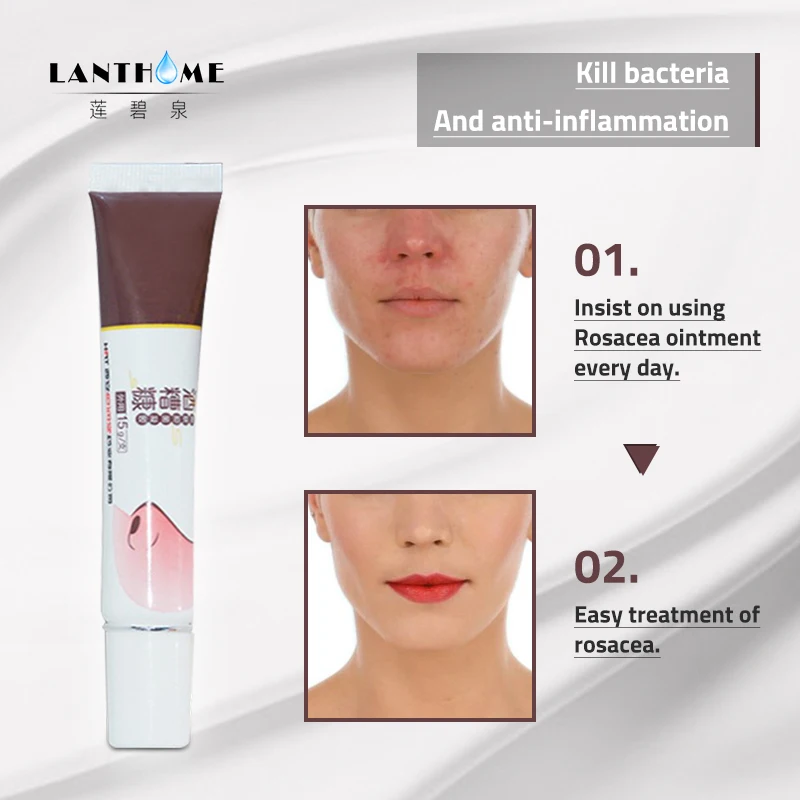 Chinese Herbal Nose Mites Anti Itch Rosacea Cream Treatment Red Nose Ointment Remover Acne Skin Redness Anti Pimple Deep Clean
Chinese Herbal Nose Mites Anti Itch Rosacea Cream Treatment Red Nose Ointment Remover Acne Skin Redness Anti Pimple Deep Clean