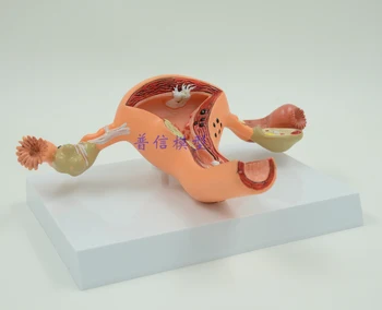The Pathological Model of The Uterus,Uterine Anatomy,genital Organ Dissect Model,Teaching for Medical
The Pathological Model of The Uterus,Uterine Anatomy,genital Organ Dissect Model,Teaching for Medical