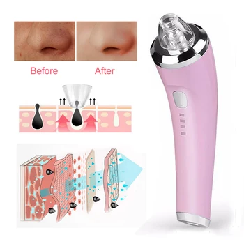 Vacuum Blackhead Cleaner Face Cleaning Suction Pore Acne Black Spots Electric Extractor Machine Pimple Remover Skin Care tool
Vacuum Blackhead Cleaner Face Cleaning Suction Pore Acne Black Spots Electric Extractor Machine Pimple Remover Skin Care tool