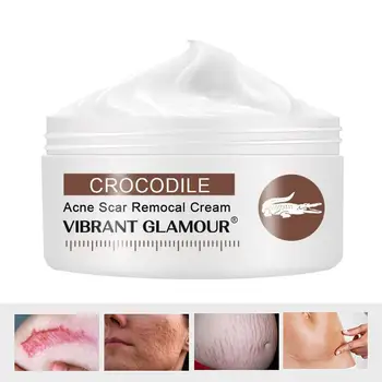 30g VIBRANT GLAMOUR Crocodile Scar Cream For Old Scars Stretch Mark Removal Cream for Men & Women Stretch Marks Relief and Burns
30g VIBRANT GLAMOUR Crocodile Scar Cream For Old Scars Stretch Mark Removal Cream for Men & Women Stretch Marks Relief and Burns