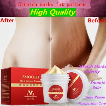 High Quality Smooth Skin Cream For Stretch Marks Scar Removal To Maternity Skin Repair Body Cream Remove Scar Care Postpartum
High Quality Smooth Skin Cream For Stretch Marks Scar Removal To Maternity Skin Repair Body Cream Remove Scar Care Postpartum
